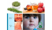 گیاهان دارویی موثر در درمان بیماری زرد زخم